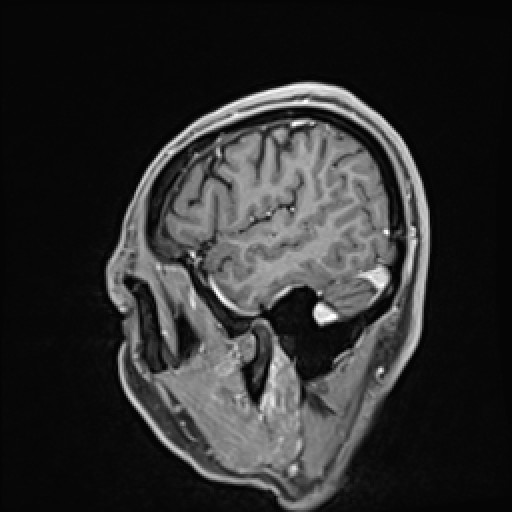 Click on the Serie image to view the images of VILLANUEVA, WILLIAM A.